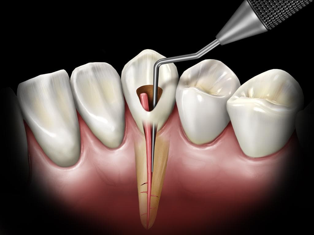Tedavi ve Endodonti